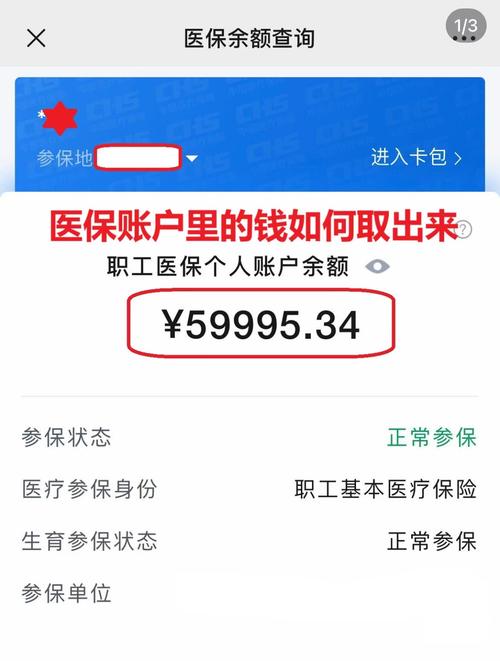 康平医保在线提取新政策解读：你的医保余额真的能随时变现吗？